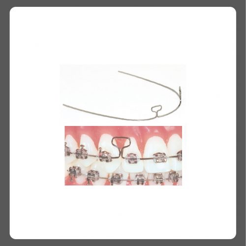 Truforce T-loop wire 16x22 , pk of 10
