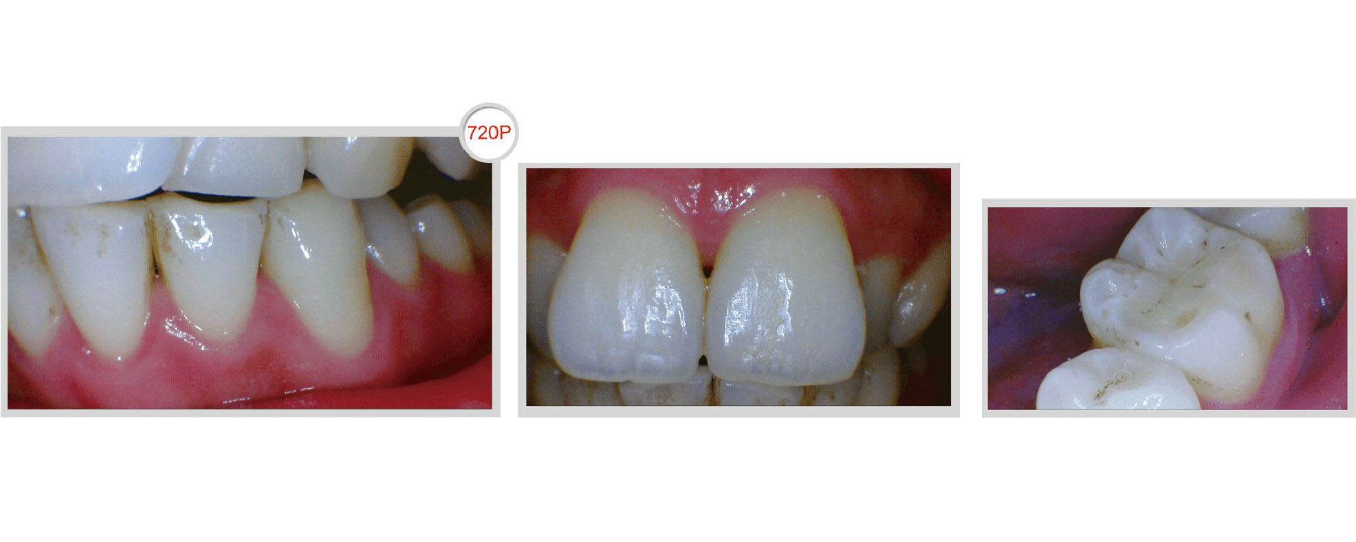 Intraoral Camera HDI-220D - Wired - Image 4
